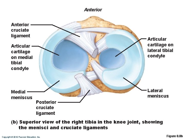 Anterior cruciate ligament Articular cartilage on lateral tibial condyle Articular cartilage on medial tibial