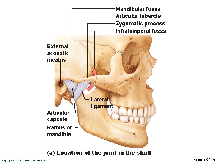 Mandibular fossa Articular tubercle Zygomatic process Infratemporal fossa External acoustic meatus Lateral ligament Articular