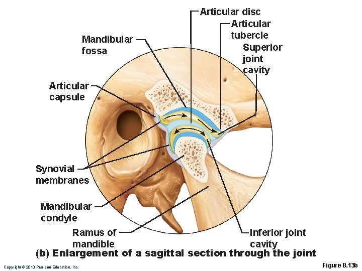 Mandibular fossa Articular disc Articular tubercle Superior joint cavity Articular capsule Synovial membranes Mandibular