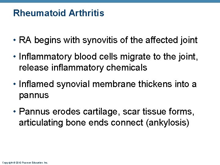 Rheumatoid Arthritis • RA begins with synovitis of the affected joint • Inflammatory blood