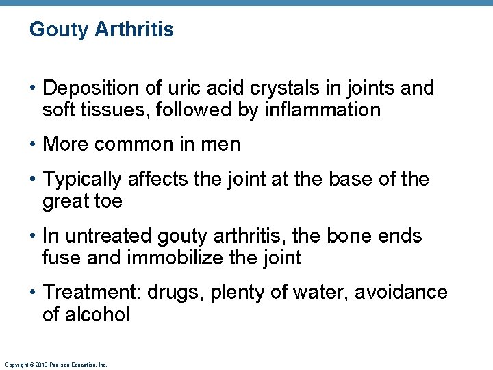 Gouty Arthritis • Deposition of uric acid crystals in joints and soft tissues, followed