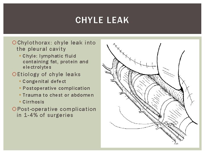 CHYLE LEAK Chylothorax: chyle leak into the pleural cavity § Chyle: lymphatic fluid containing