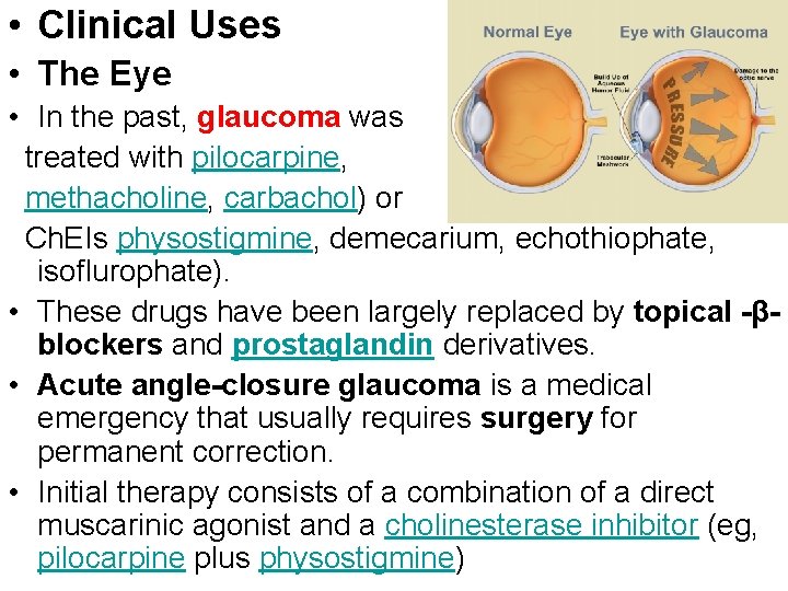  • Clinical Uses • The Eye • In the past, glaucoma was treated