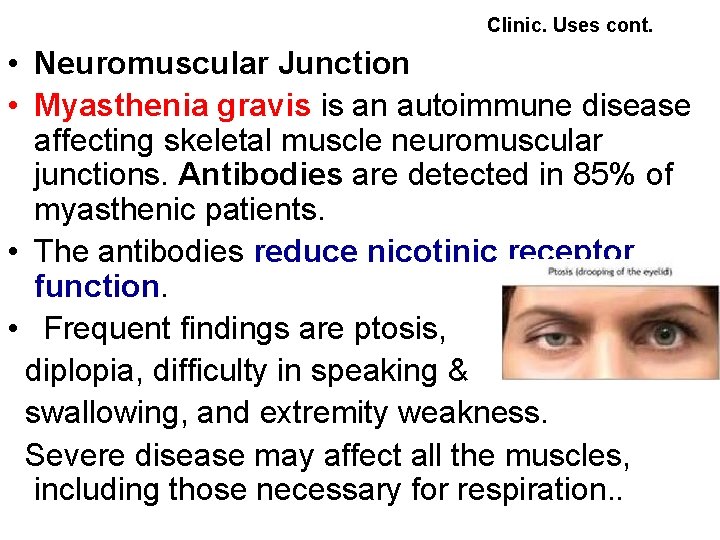  Clinic. Uses cont. • Neuromuscular Junction • Myasthenia gravis is an autoimmune disease