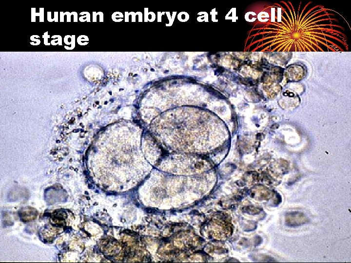 Human embryo at 4 cell stage 