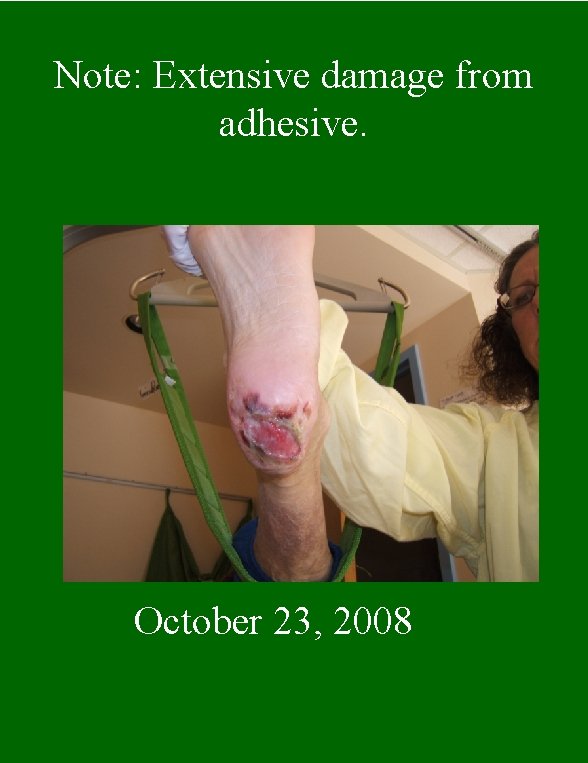 Note: Extensive damage from adhesive. October 23, 2008 