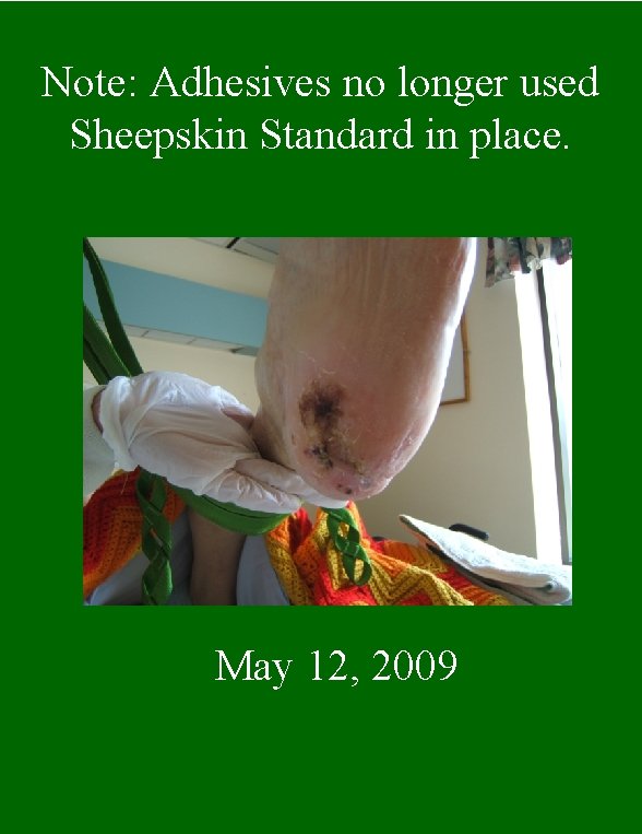 Note: Adhesives no longer used Sheepskin Standard in place. May 12, 2009 