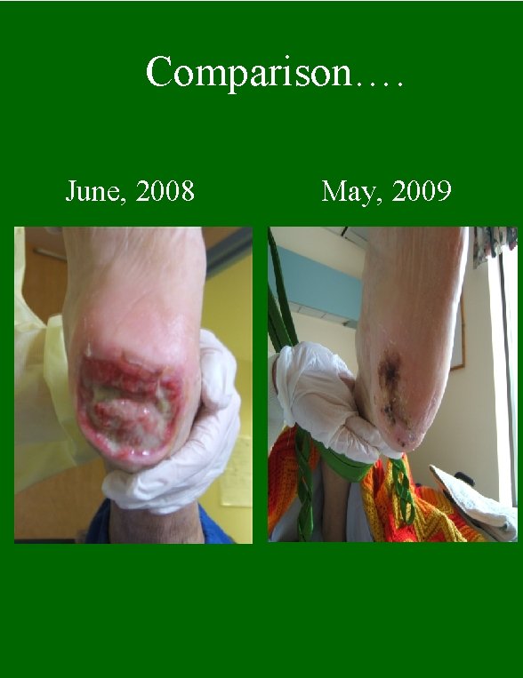 Comparison…. June, 2008 May, 2009 