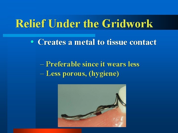 Relief Under the Gridwork Creates a metal to tissue contact – Preferable since it