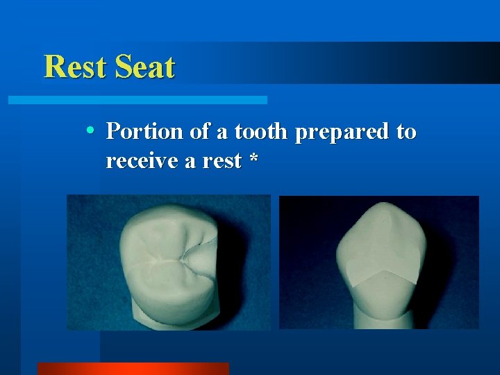 Rest Seat Portion of a tooth prepared to receive a rest * 