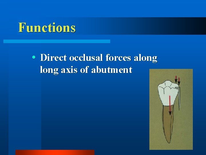 Functions Direct occlusal forces along axis of abutment 