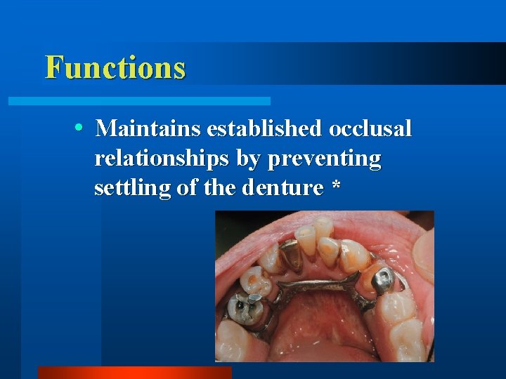 Functions Maintains established occlusal relationships by preventing settling of the denture * 