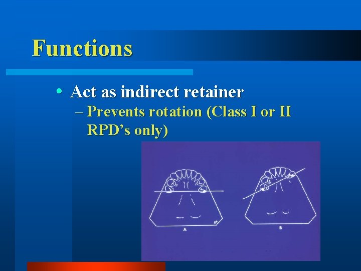 Functions Act as indirect retainer – Prevents rotation (Class I or II RPD’s only)
