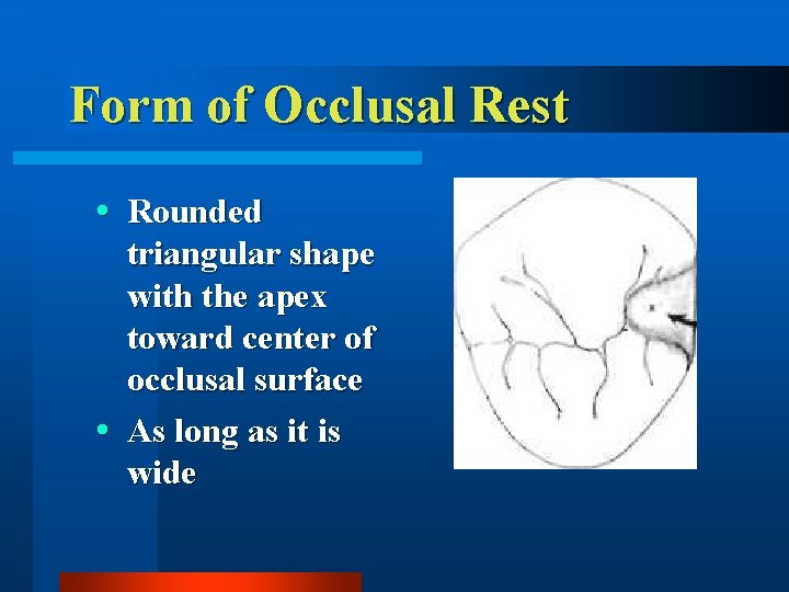 Form of Occlusal Rest Rounded triangular shape with the apex toward center of occlusal