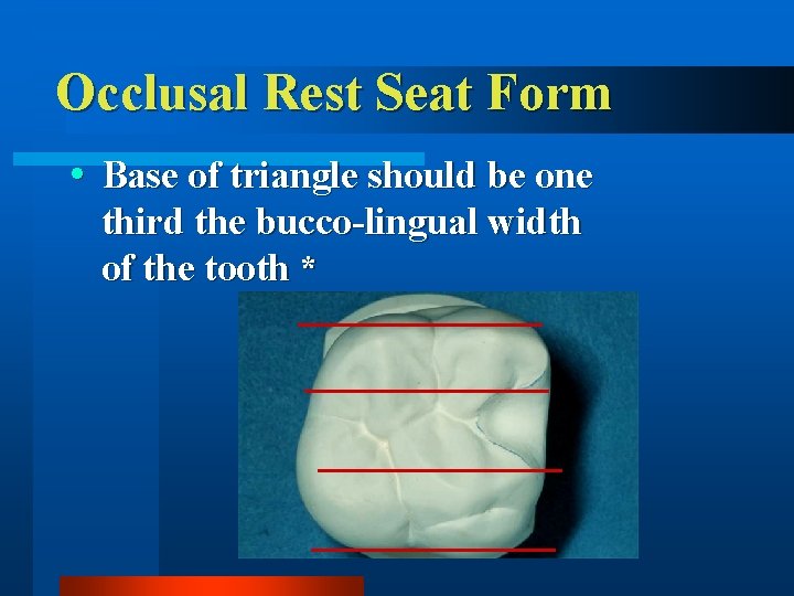 Occlusal Rest Seat Form Base of triangle should be one third the bucco-lingual width