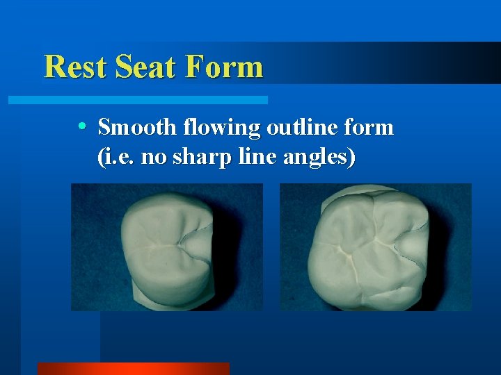 Rest Seat Form Smooth flowing outline form (i. e. no sharp line angles) 