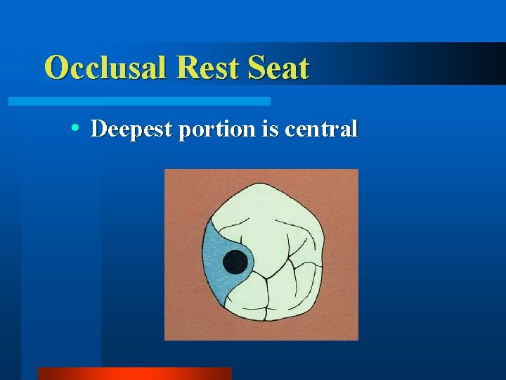 Occlusal Rest Seat Deepest portion is central 