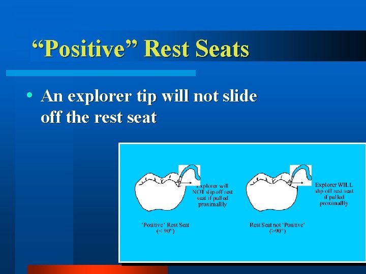 “Positive” Rest Seats An explorer tip will not slide off the rest seat 