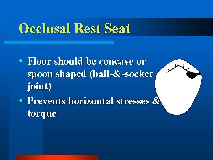 Occlusal Rest Seat Floor should be concave or spoon shaped (ball-&-socket joint) Prevents horizontal