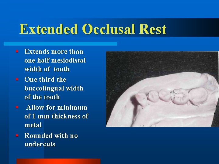 Extended Occlusal Rest § Extends more than one half mesiodistal width of tooth §