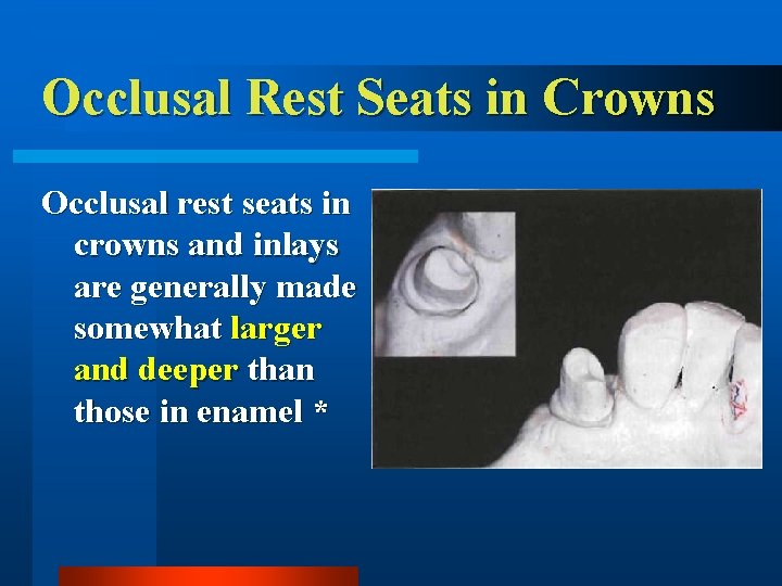Occlusal Rest Seats in Crowns Occlusal rest seats in crowns and inlays are generally
