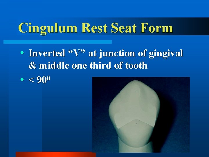 Cingulum Rest Seat Form Inverted “V” at junction of gingival & middle one third