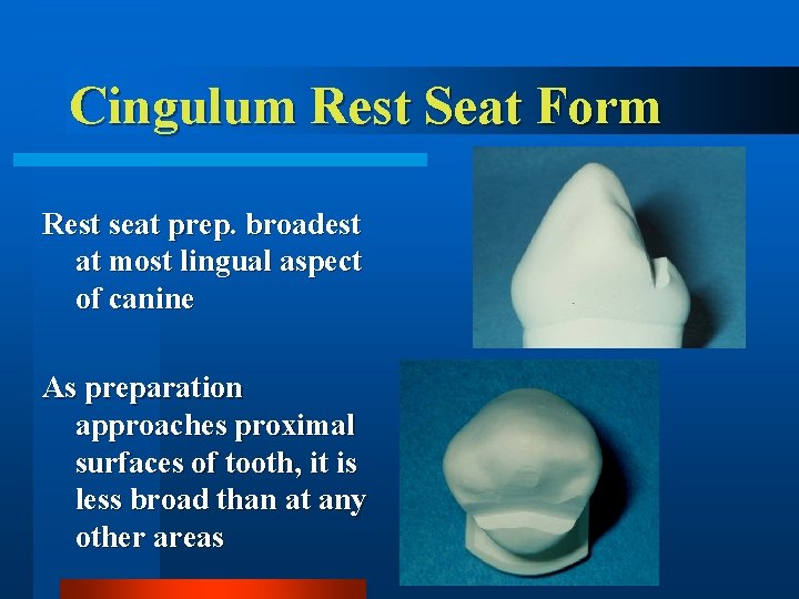 Cingulum Rest Seat Form Rest seat prep. broadest at most lingual aspect of canine