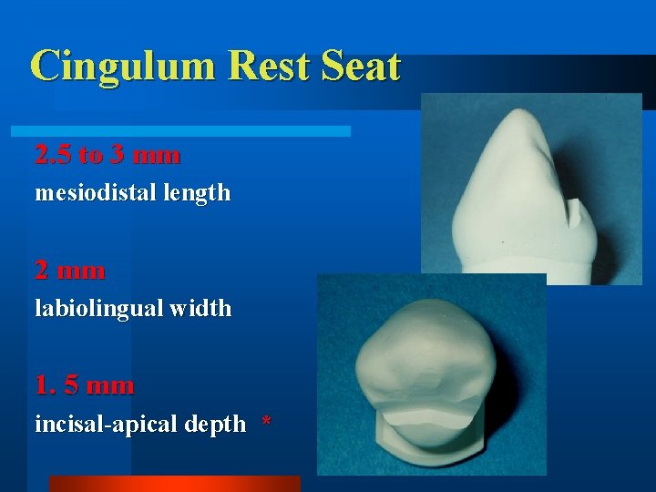 Cingulum Rest Seat 2. 5 to 3 mm mesiodistal length 2 mm labiolingual width