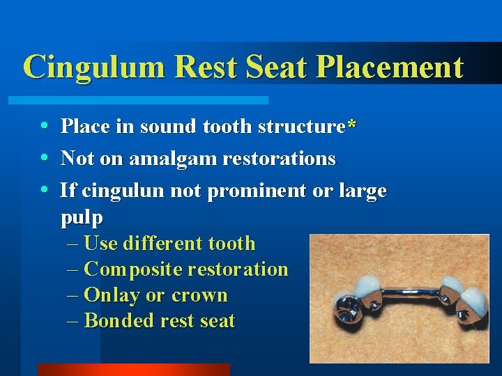Cingulum Rest Seat Placement Place in sound tooth structure* Not on amalgam restorations If