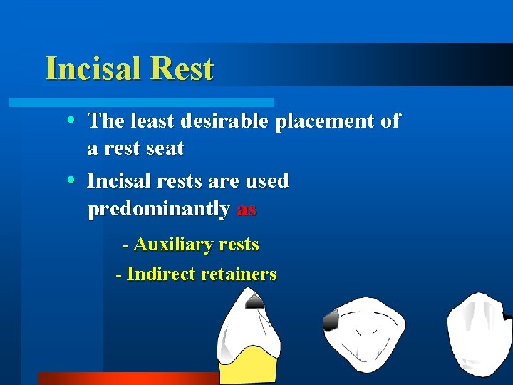 Incisal Rest The least desirable placement of a rest seat Incisal rests are used