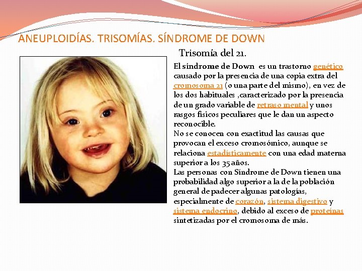 ANEUPLOIDÍAS. TRISOMÍAS. SÍNDROME DE DOWN Trisomía del 21. El síndrome de Down es un