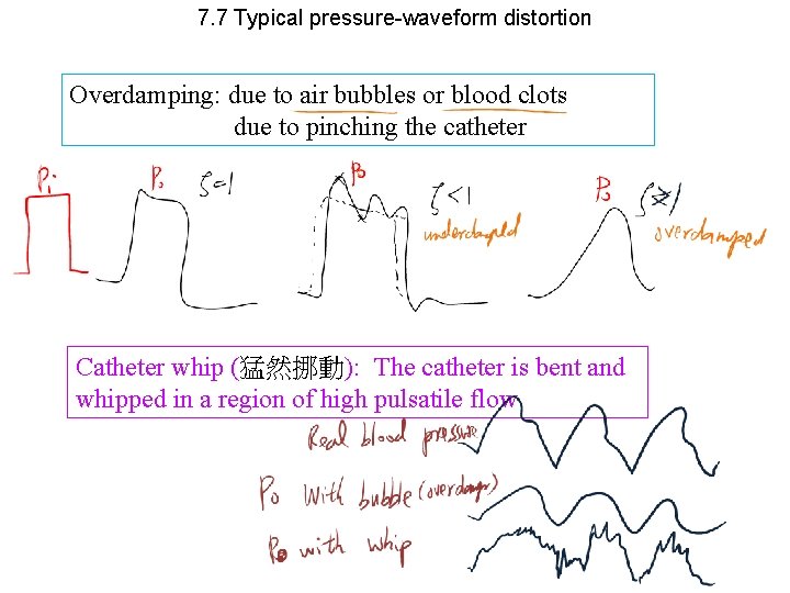 7. 7 Typical pressure-waveform distortion Overdamping: due to air bubbles or blood clots due