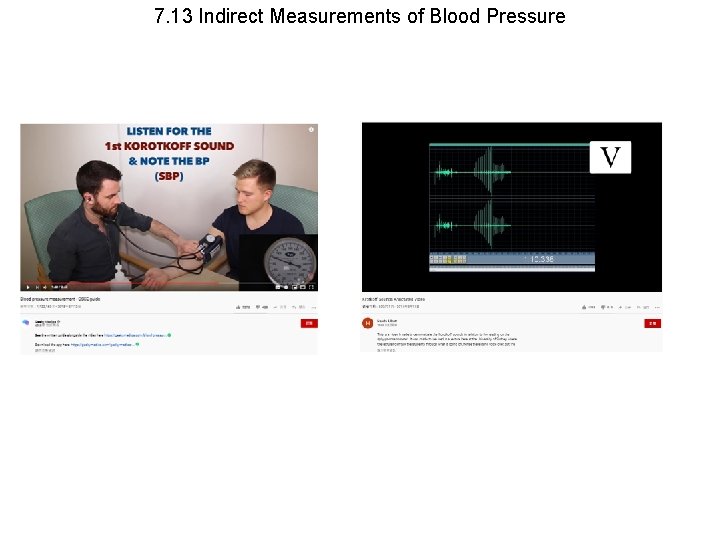7. 13 Indirect Measurements of Blood Pressure 