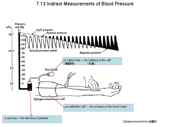7. 13 Indirect Measurements of Blood Pressure A rubber bulb for inflation of the