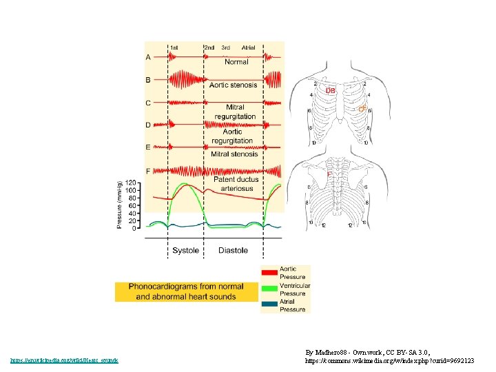 https: //en. wikipedia. org/wiki/Heart_sounds By Madhero 88 - Own work, CC BY-SA 3. 0,