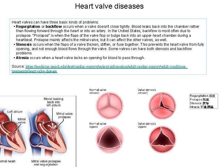 Heart valve diseases Heart valves can have three basic kinds of problems: • Regurgitation