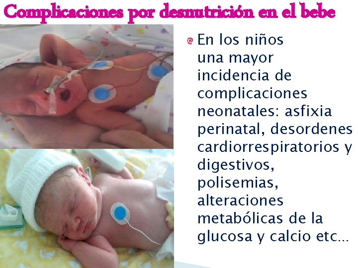 Complicaciones por desnutrición en el bebe En los niños una mayor incidencia de complicaciones