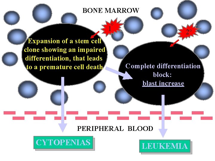 BONE MARROW 1° Expansion of a stem cell clone showing an impaired differentiation, that