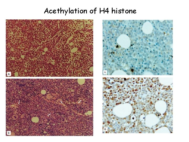 Acethylation of H 4 histone 