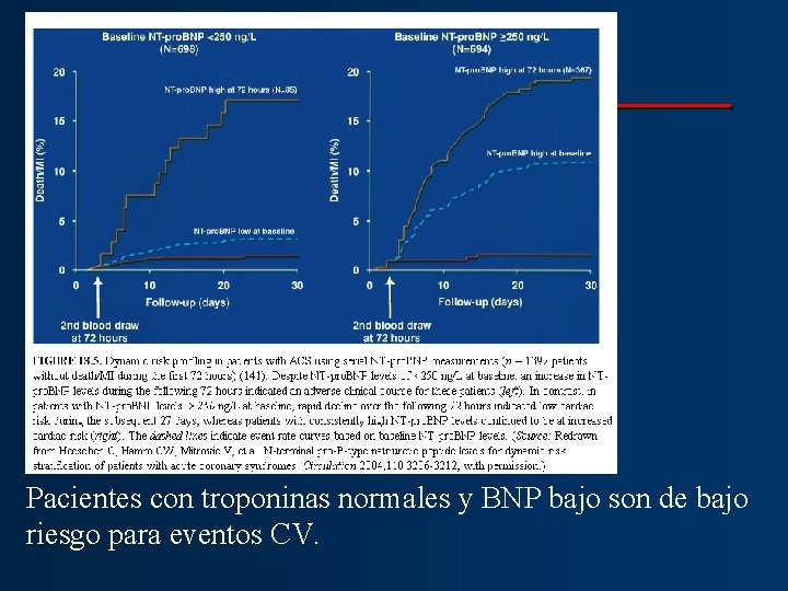 Pacientes con troponinas normales y BNP bajo son de bajo riesgo para eventos CV.