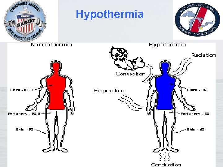 Hypothermia 