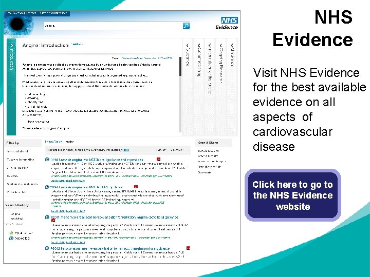 NHS Evidence Visit NHS Evidence for the best available evidence on all aspects of