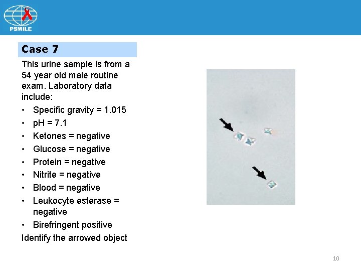 Case 7 This urine sample is from a 54 year old male routine exam.