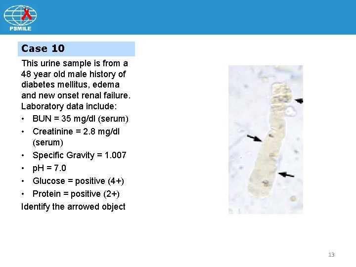 Case 10 This urine sample is from a 48 year old male history of
