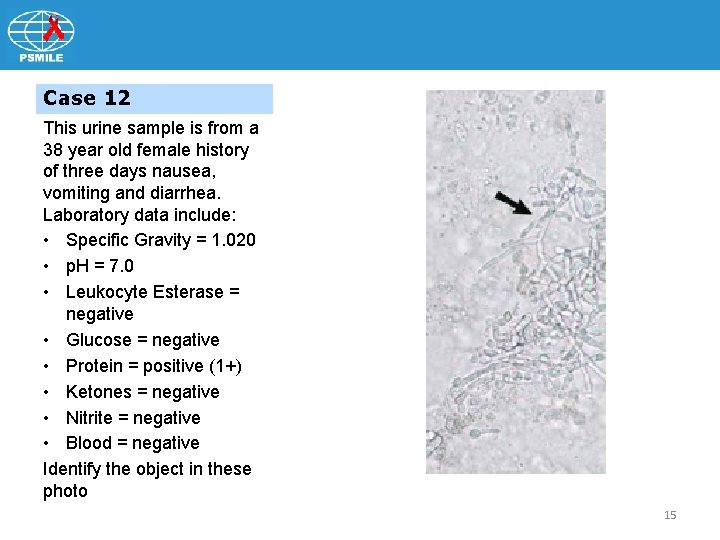 Case 12 This urine sample is from a 38 year old female history of