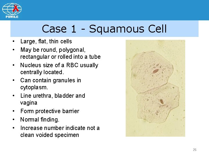 Case 1 - Squamous Cell • Large, flat, thin cells • May be round,