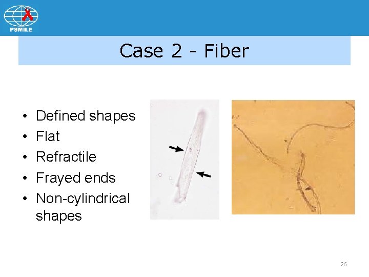 Case 2 - Fiber • • • Defined shapes Flat Refractile Frayed ends Non-cylindrical