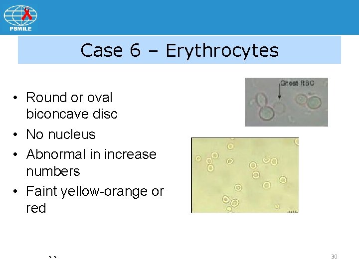 Case 6 – Erythrocytes • Round or oval biconcave disc • No nucleus •