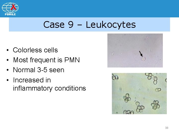 Case 9 – Leukocytes • • Colorless cells Most frequent is PMN Normal 3