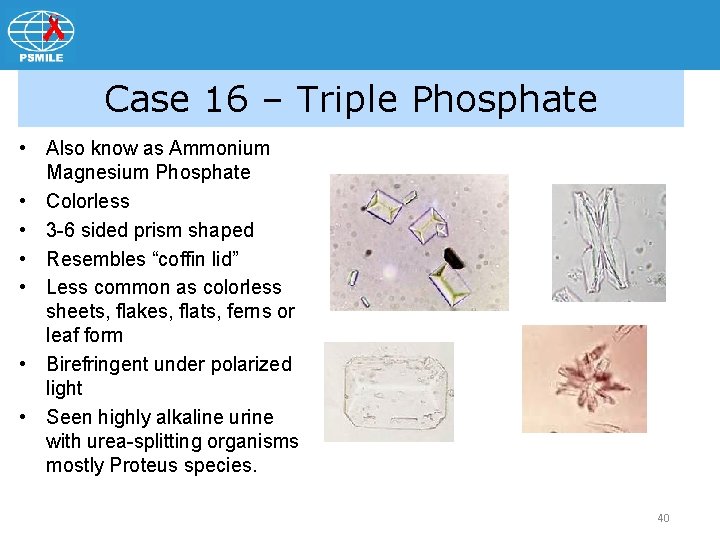 Case 16 – Triple Phosphate • Also know as Ammonium Magnesium Phosphate • Colorless